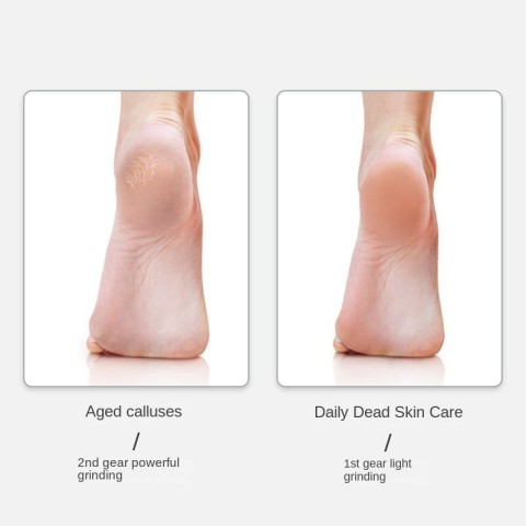 Electric Mini Portable Foot Grinder and Callus Remover