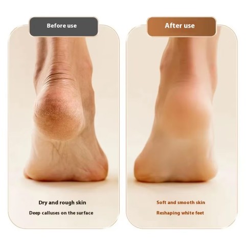 Portable Electric Foot Grinder