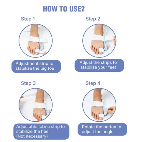 Adjustable Toe Separator for Hallux Valgus Correction